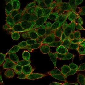 BCL11A/CTIP1 (Transcription Factor) Antibody in Immunocytochemistry (ICC/IF)