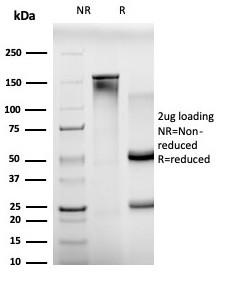 BCL11A/CTIP1 (Transcription Factor) Antibody in SDS-PAGE (SDS-PAGE)