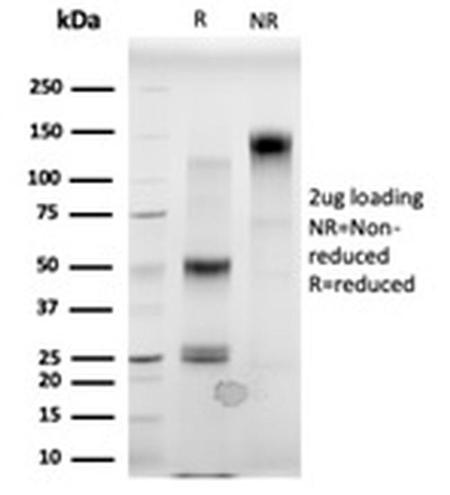 MBD3 Antibody in SDS-PAGE (SDS-PAGE)