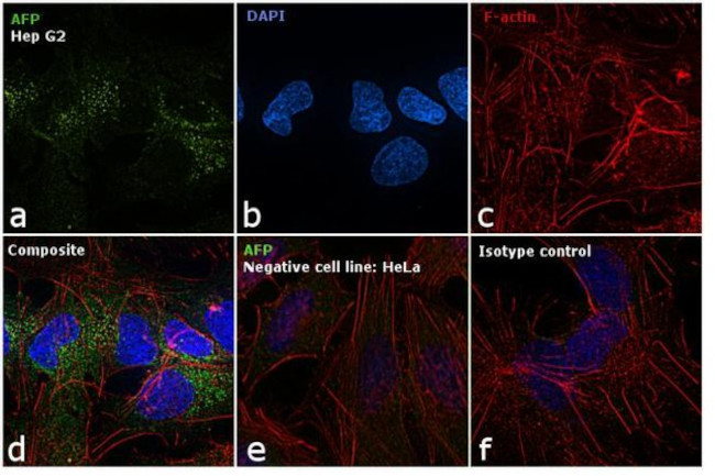 alpha-Fetoprotein Antibody