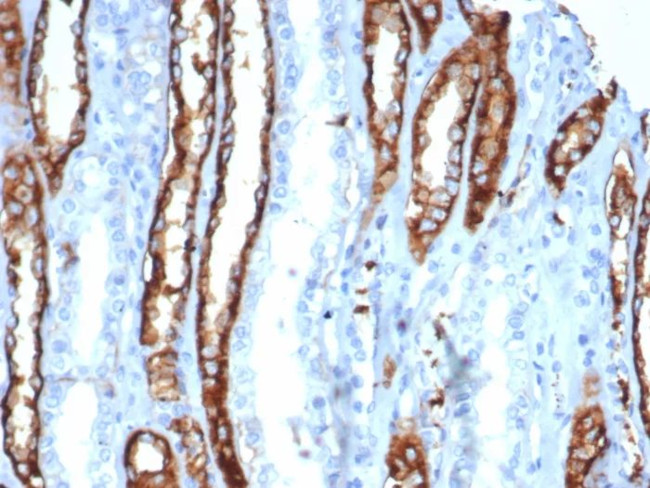 IL20RA (Interleukin 20 Receptor Subunit Alpha) Antibody in Immunohistochemistry (Paraffin) (IHC (P))