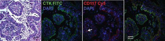 Pan Cytokeratin Antibody in Immunohistochemistry (IHC)