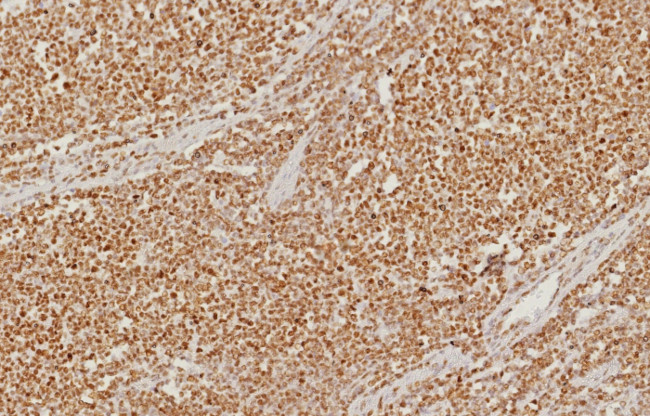 PMS2 (Postmeiotic Segregation Increased 2) Antibody in Immunohistochemistry (Paraffin) (IHC (P))