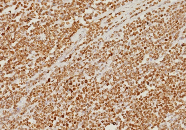 PMS2 (Postmeiotic Segregation Increased 2) Antibody in Immunohistochemistry (Paraffin) (IHC (P))