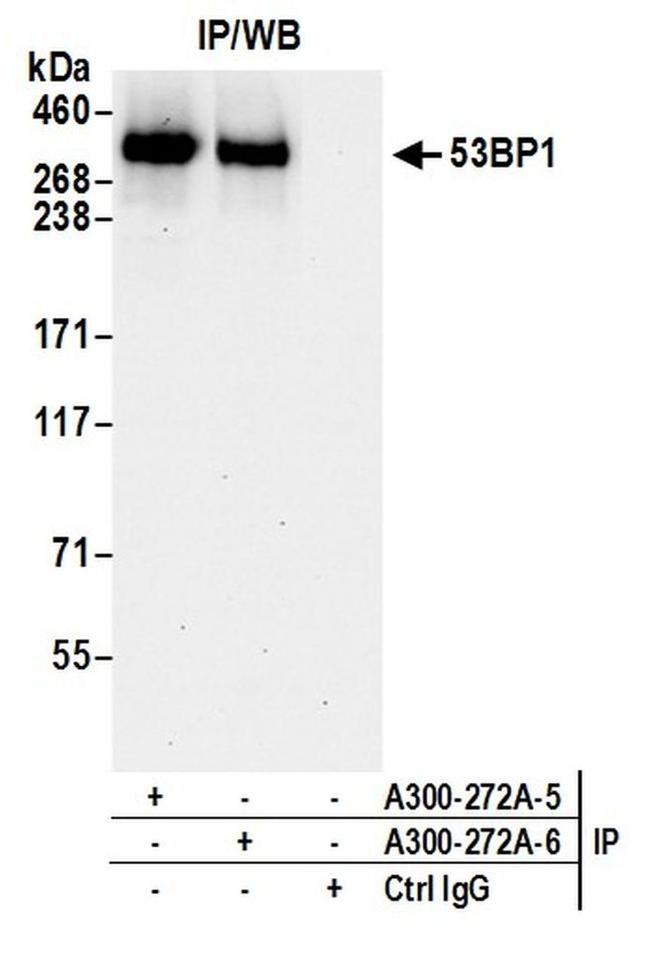 53BP1 Antibody in Western Blot (WB)