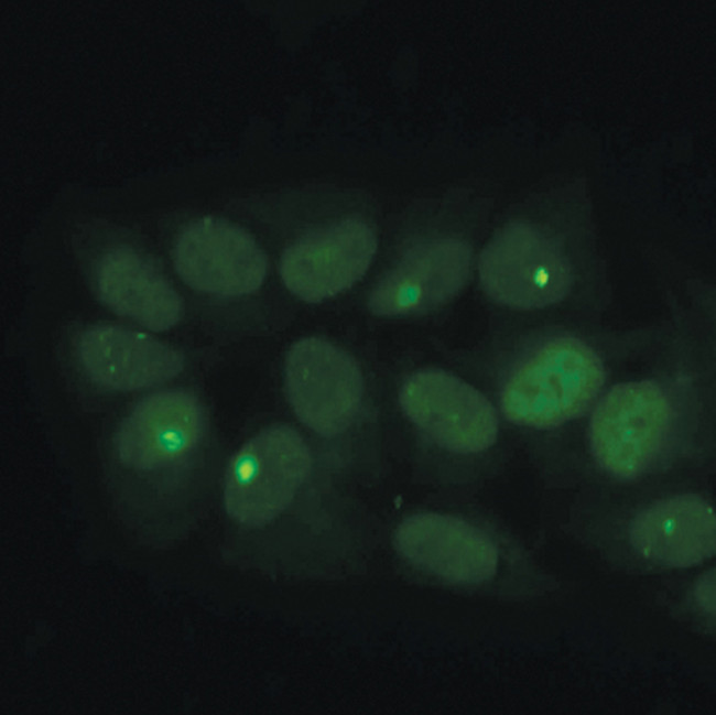 53BP1 Antibody in Immunocytochemistry (ICC/IF)