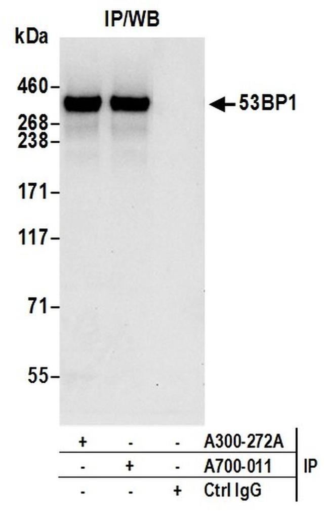 53BP1 Antibody in Western Blot (WB)