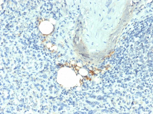 TRAcP (Tartrate-Resistant Acid Phosphatase) Antibody in Immunohistochemistry (Paraffin) (IHC (P))