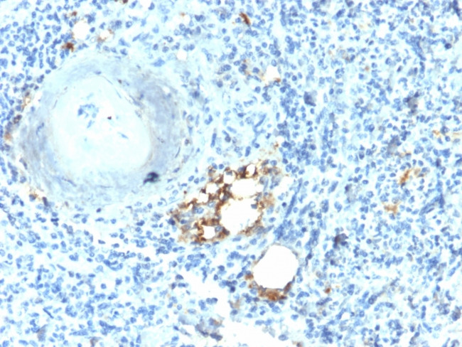 TRAcP (Tartrate-Resistant Acid Phosphatase) Antibody in Immunohistochemistry (Paraffin) (IHC (P))