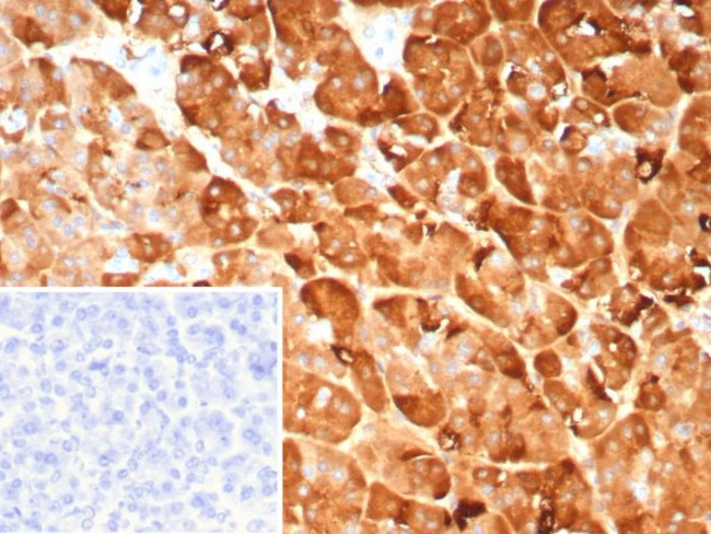 Pancreatic lipase/PNLIP Antibody in Immunohistochemistry (Paraffin) (IHC (P))