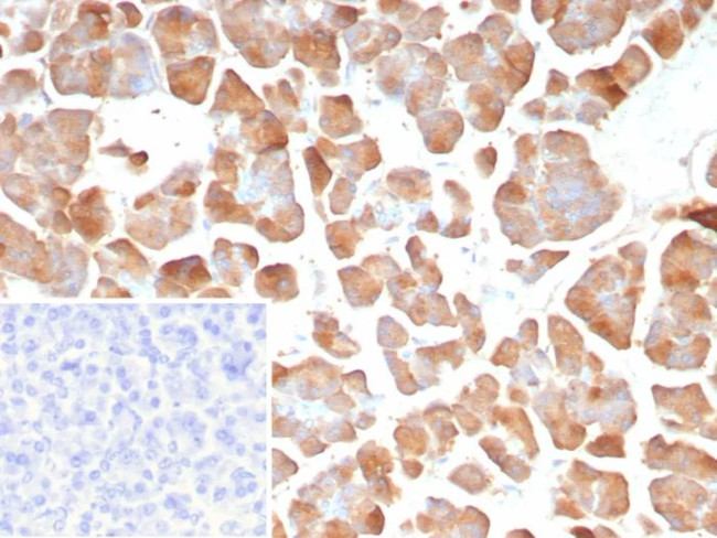 Pancreatic lipase/PNLIP Antibody in Immunohistochemistry (Paraffin) (IHC (P))