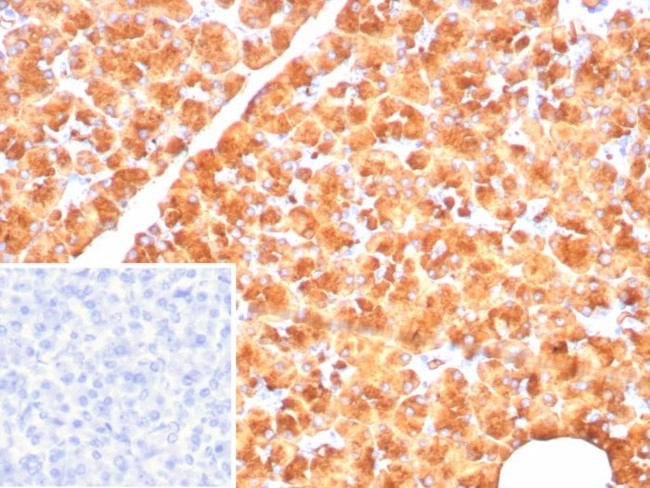 Pancreatic lipase/PNLIP Antibody in Immunohistochemistry (Paraffin) (IHC (P))