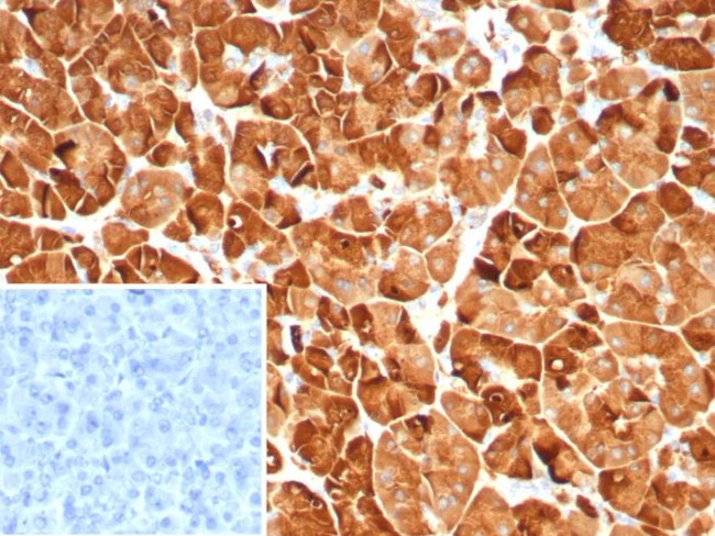 Pancreatic lipase/PNLIP Antibody in Immunohistochemistry (Paraffin) (IHC (P))