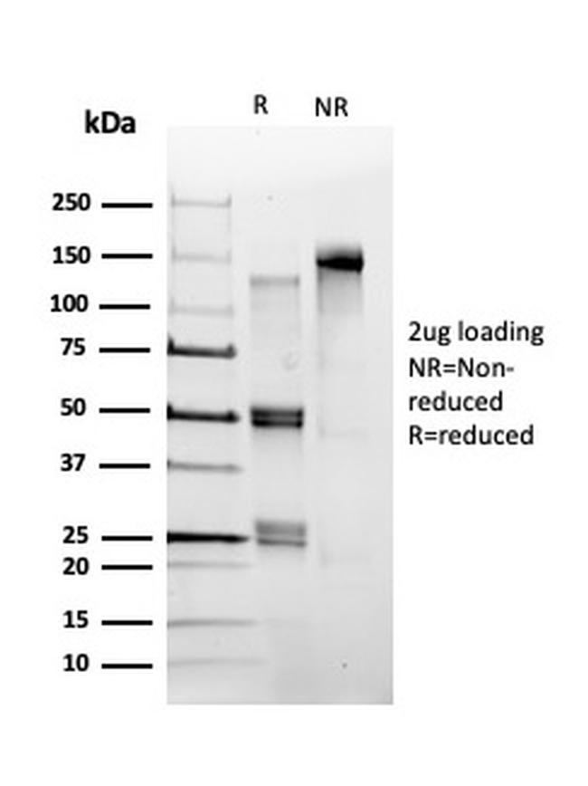 POLE3/CHRAC17 Antibody in SDS-PAGE (SDS-PAGE)