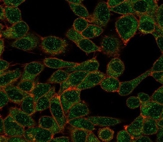 POLE3/CHRAC17 Antibody in Immunocytochemistry (ICC/IF)