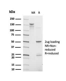 POLE3/CHRAC17 Antibody in SDS-PAGE (SDS-PAGE)