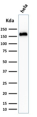 Podocalyxin (PODXL) (Hematopoietic Stem Cell Marker) Antibody in Western Blot (WB)