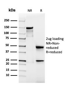 Podocalyxin (PODXL) (Hematopoietic Stem Cell Marker) Antibody in SDS-PAGE (SDS-PAGE)