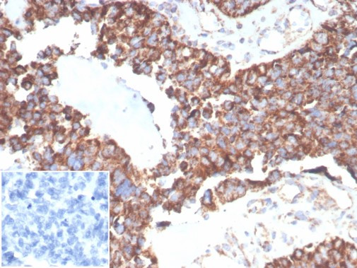 TREM2 (Triggering Receptor Expressed On Myeloid Cells 2) Antibody in Immunohistochemistry (Paraffin) (IHC (P))