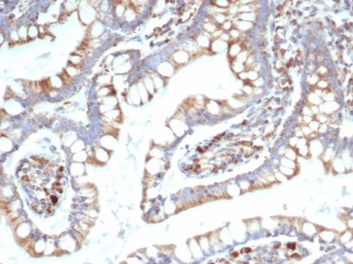 TREM2 (Triggering Receptor Expressed On Myeloid Cells 2) Antibody in Immunohistochemistry (Paraffin) (IHC (P))