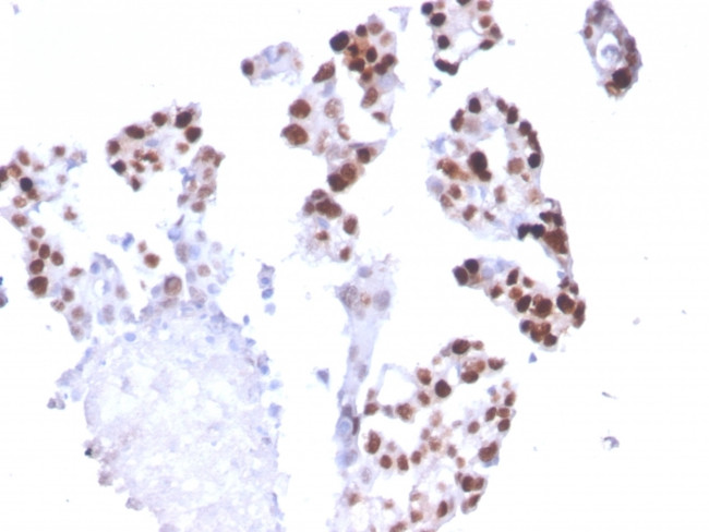 RNA Polymerase II Antibody in Immunohistochemistry (Paraffin) (IHC (P))