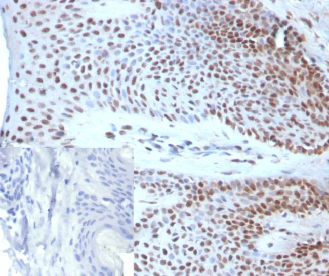 SOX18 Antibody in Immunohistochemistry (Paraffin) (IHC (P))