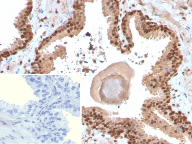 SOX18 Antibody in Immunohistochemistry (Paraffin) (IHC (P))