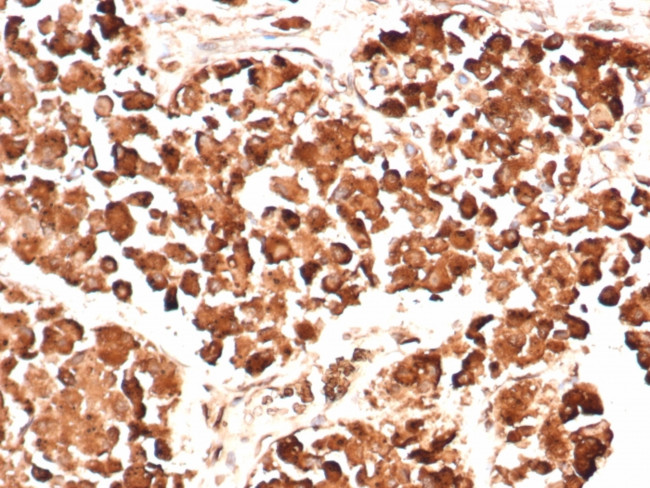 ACTH (Adrenocorticotrophic Hormone) (Pituitary Marker) Antibody in Immunohistochemistry (Paraffin) (IHC (P))