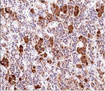 ACTH (Adrenocorticotrophic Hormone) (Pituitary Marker) Antibody in Immunohistochemistry (Paraffin) (IHC (P))