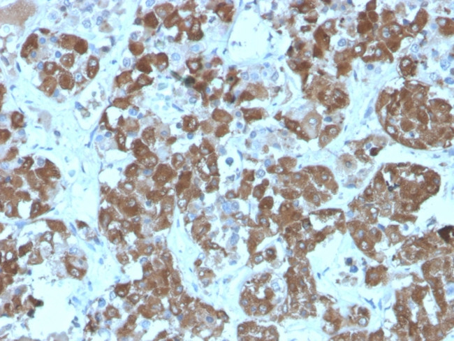 ACTH (Adrenocorticotrophic Hormone) (Pituitary Marker) Antibody in Immunohistochemistry (Paraffin) (IHC (P))