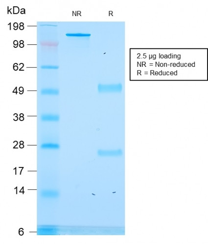 ACTH (Adrenocorticotrophic Hormone) Antibody in SDS-PAGE (SDS-PAGE)