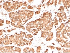 ACTH (Adrenocorticotrophic Hormone) (Pituitary Marker) Antibody in Immunohistochemistry (Paraffin) (IHC (P))