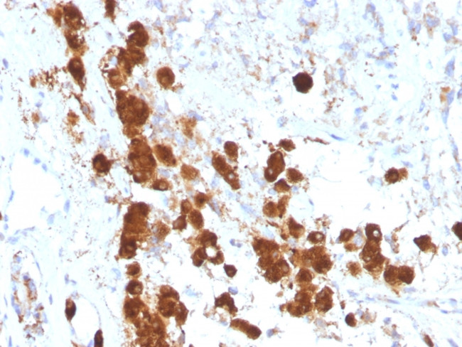 ACTH (Adrenocorticotrophic Hormone) (Adrenal Marker) Antibody in Immunohistochemistry (Paraffin) (IHC (P))