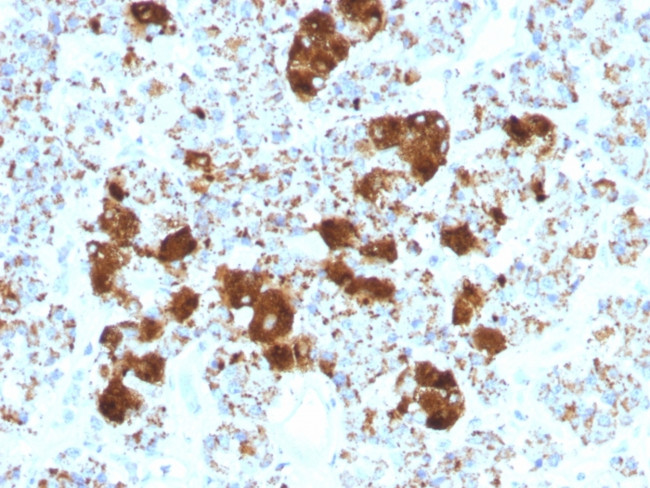 ACTH (Adrenocorticotrophic Hormone) (Pituitary Marker) Antibody in Immunohistochemistry (Paraffin) (IHC (P))