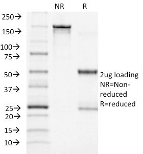 ACTH (Adrenocorticotrophic Hormone) Antibody in SDS-PAGE (SDS-PAGE)