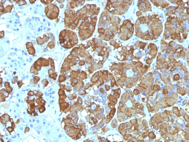 ACTH (Adrenocorticotrophic Hormone) Antibody in Immunohistochemistry (Paraffin) (IHC (P))