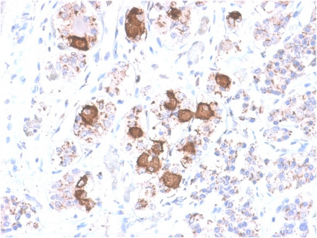 ACTH (Adrenocorticotrophic Hormone) (Pituitary Marker) Antibody in Immunohistochemistry (Paraffin) (IHC (P))