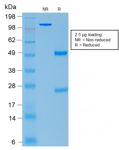 ACTH (Adrenocorticotrophic Hormone) (Pituitary Marker) Antibody in SDS-PAGE (SDS-PAGE)