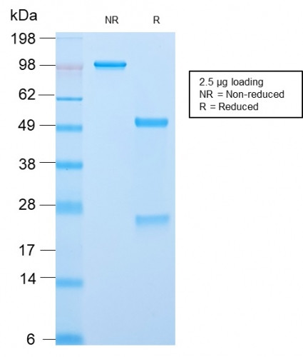 ACTH (Adrenocorticotrophic Hormone) Antibody in SDS-PAGE (SDS-PAGE)