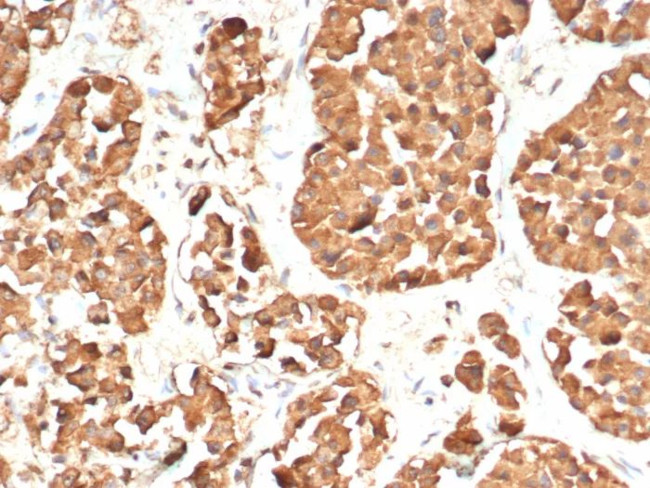 ACTH (Adrenocorticotrophic Hormone) (N-Terminal) (Pituitary Marker) Antibody in Immunohistochemistry (Paraffin) (IHC (P))