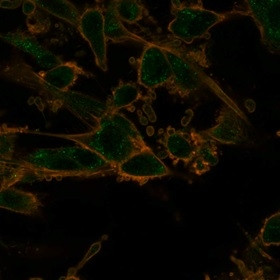 PRMT7 Antibody in Immunocytochemistry (ICC/IF)