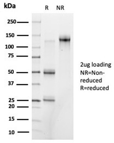 PRMT7 Antibody in SDS-PAGE (SDS-PAGE)