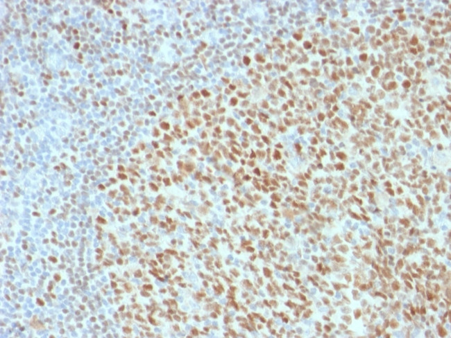 OCT-2 (POU2F2) Antibody in Immunohistochemistry (Paraffin) (IHC (P))