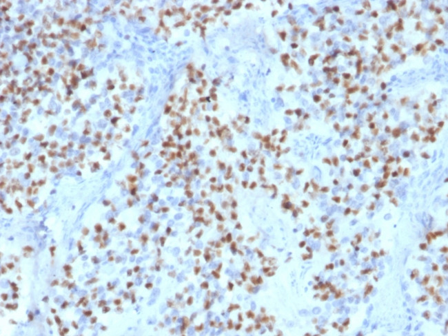 OCT-2 (POU2F2) Antibody in Immunohistochemistry (Paraffin) (IHC (P))