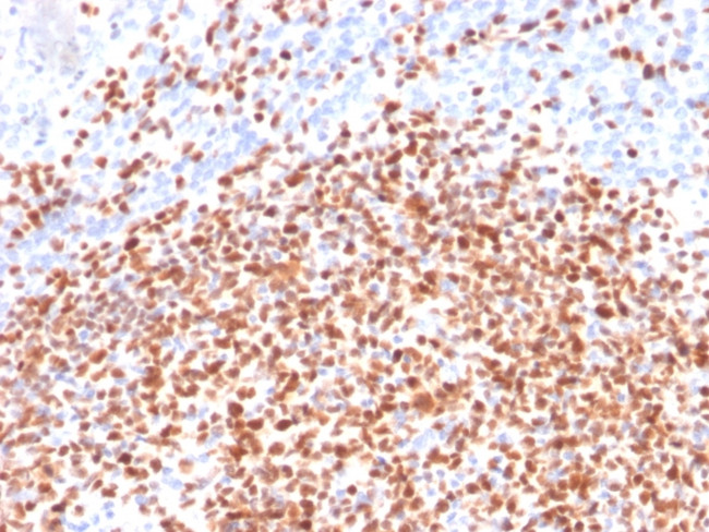 OCT-2 (POU2F2) Antibody in Immunohistochemistry (Paraffin) (IHC (P))