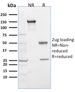 EGLN1/PHD2 Antibody in SDS-PAGE (SDS-PAGE)