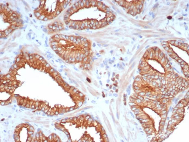 LINE1 type transposase domain containing 1/L1TD1 Antibody in Immunohistochemistry (Paraffin) (IHC (P))