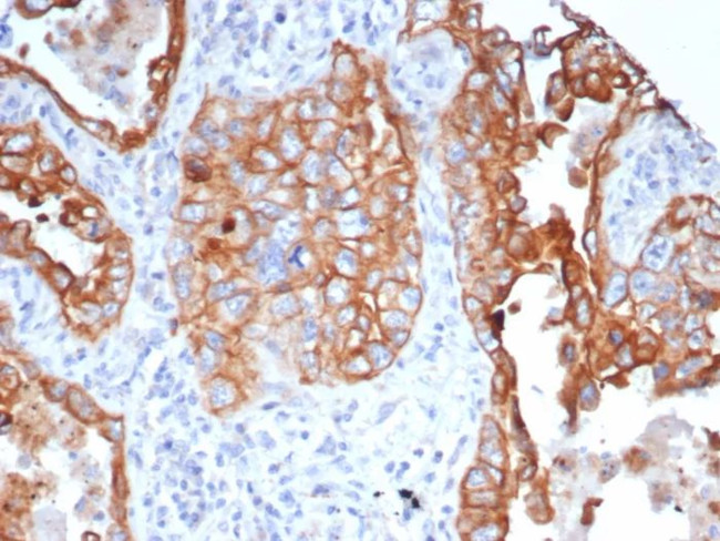 LINE1 type transposase domain containing 1/L1TD1 Antibody in Immunohistochemistry (Paraffin) (IHC (P))