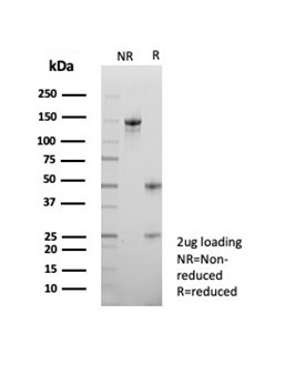 ATRX/RAD54 (Alpha Thalassemia Mental Retardation) Antibody in SDS-PAGE (SDS-PAGE)