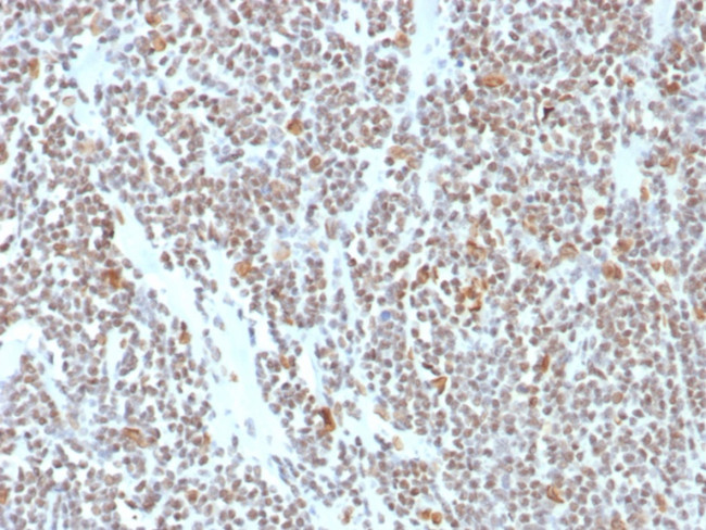 ATRX/RAD54 (Alpha Thalassemia Mental Retardation) Antibody in Immunohistochemistry (Paraffin) (IHC (P))